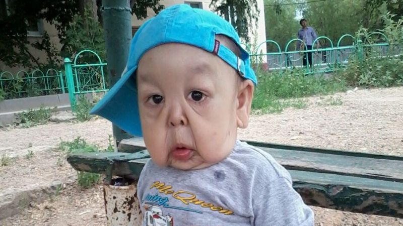 Астаналық төрт жасар бала күн санап қартайып бара жатыр (фото)